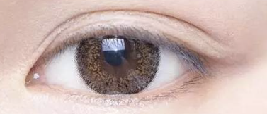 双眼皮手术与提眉术能否