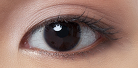 眼周双术联做：双眼皮与提眉术的协同与风险管控