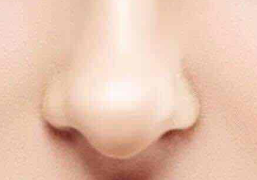 鼻炎患者能否做鼻头矫正？科学判断手术时机是关键