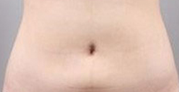 吸脂术后塑身衣大揭秘！探店实测告诉你真相