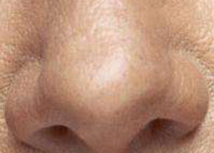 鼻头矫正术后饮酒指南：术后1个月内请远离酒精