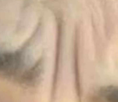 注射后刷牙避坑指南：这4个常见误区正在悄悄影响效果！