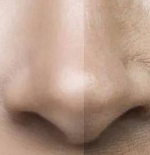 鼻头矫正术后备孕避坑指南：把握时间，安心孕育