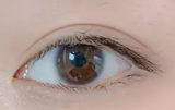 埋线双眼皮术后隐形眼镜佩戴：从专业视角看关键要点