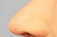 鼻翼矫正术前饮食实录：3个真实案例揭秘