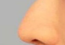 鼻翼矫正术前饮食避坑指南：这5个致命误区让手术风险飙升300%！