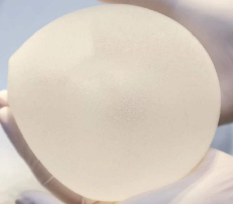 隆胸手术医保报销“探店”实录：从“美容陷阱”到“医疗救济”的真相揭秘