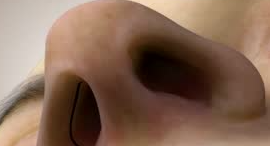 鼻翼矫正术前饮食实测：全麻禁食8小时VS局麻少量进食的真相揭秘