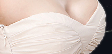 隆胸切口选择全攻略：隐蔽、精准与暴露的“三角博弈”