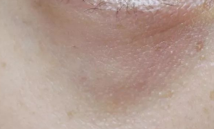 黑眼圈“元凶”大揭秘：这些生活习惯正在悄悄加重你的眼部危机-55942