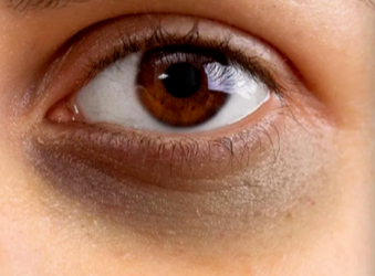 黑眼圈加重的5大“雷区”，你踩中几个？-55945