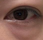 黑眼圈“避坑指南”：5个日常习惯正在悄悄毁掉你的眼周-55956