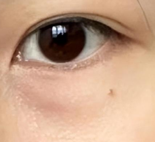 眼袋越大越显老？科学点评：别让“伪常识”误导你的抗衰路