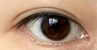 开眼角术后能游泳吗？避开这3个风险期，守护你的“电眼”恢复