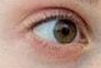开内眼角后眼神变化测评：科学设计避免“变凶”风险