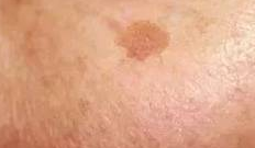 淡斑期游泳实录：科学护理让美丽与运动同行-55959