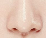 探店实测！鼻翼矫正假体材料怎么选？硅胶/膨体/自体软骨“避坑指南”来了