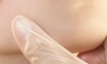 瘦脸治疗“持久战”还是“一劳永逸”？真实案例揭秘注射与手术差异