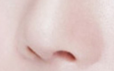 深度测评：鼻翼矫正术对医生技术要求有多高？