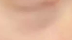 国内外去眼袋技术对比：微创与个性化成国际新趋势-56022