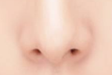 复杂鼻翼矫正：分阶段手术是“刚需”还是“可选项”？