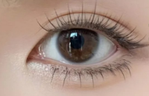 埋线双眼皮VS三点定位双眼皮：精准解析两大术式的核心差异