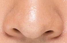 鼻翼矫正术后饮食指南：科学调养助力快速恢复