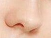 鼻翼矫正手术效果持久性大测评：自体软骨、软组织调整、人工材料谁更“抗老”？