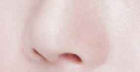 鼻翼矫正术后伤口清洁全攻略：无菌护理+轻柔操作，加速恢复不留痕