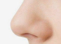 鼻翼矫正手术风险深度剖析：鼻孔变形是“必然”还是“偶然”？