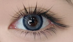 未成年人埋线双眼皮手术测评：谨慎抉择，守护成长之美