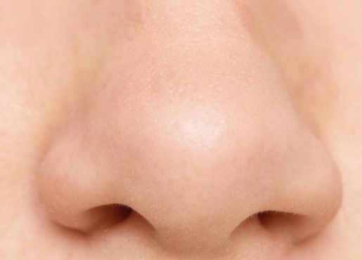 鼻翼矫正手术效果持久性大揭秘：不同术式维持时间全解析