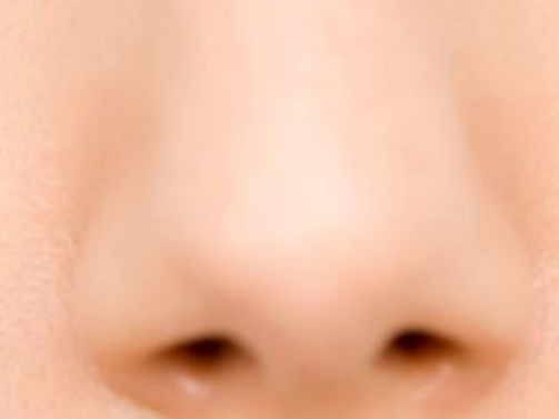 鼻翼矫正术后复查全攻略：守护美丽不“掉线”