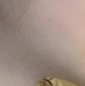 丰面颊术前检查全解析：四大项目守护你的变美之路