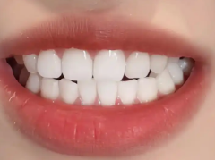 牙齿矫正避坑指南：三大核心因素决定你的矫正费用