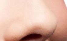 从“馒头鼻”到精致轮廓：28岁女孩的鼻翼矫正消肿实战记