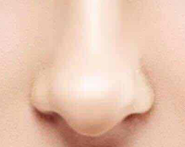 鼻翼矫正术后消肿避坑指南：这些误区千万别踩！