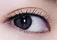 埋线双眼皮术后能否熬夜？术后护理关键点解析-56103