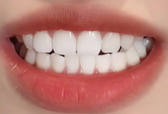 牙齿矫正费用全解析：三大核心因素决定你的预算