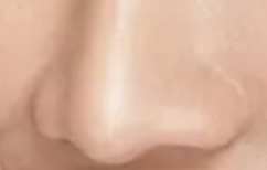 鼻翼矫正“功能与美学”双保障指南：科学手术如何兼顾呼吸与颜值