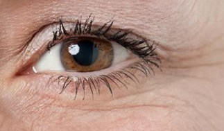 注射除皱选材大揭秘：进口VS国产，如何找到适合自己的