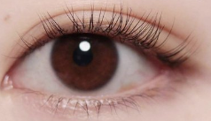 埋线双眼皮术后“眼周血管瘤”增大：应对策略与医学排查-56130