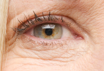 玻尿酸与“动态管理”项目能否联用？科学分层实现1+1＞2的变美逻辑