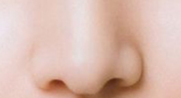 鼻孔矫正术前心理准备指南：从容迎接美丽蜕变