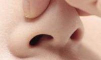 疤痕体质能否做鼻翼矫正手术？科学评估与应对策略全解析-56242